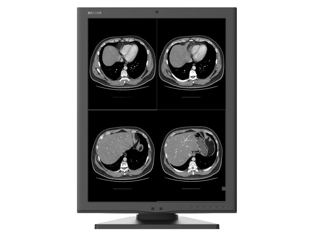 Медицинский монохромный монитор 2 МП Jusha M260G